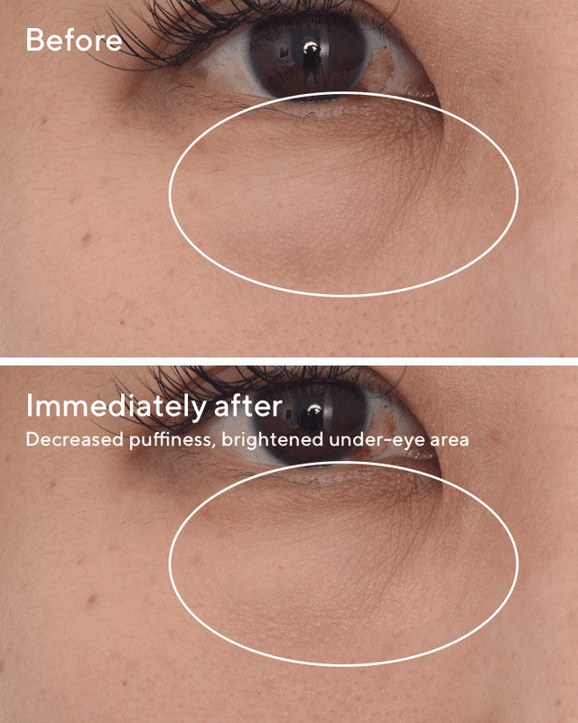 Targeted Eye Depuffer before and after