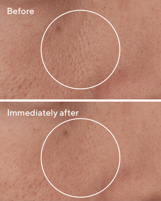 Targeted POre Corrector Before & AFter