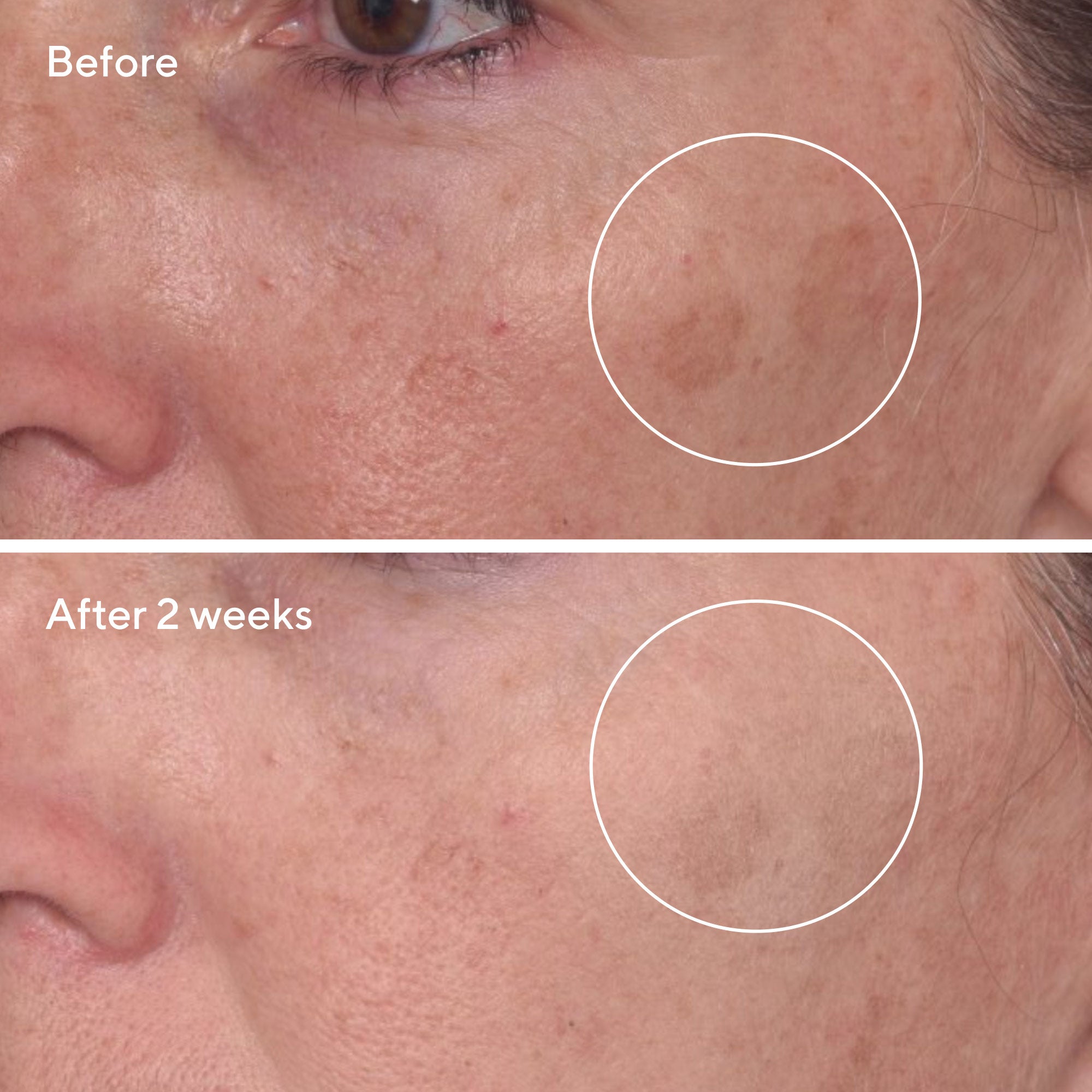 Rapid Dark Spot Correcting Serum