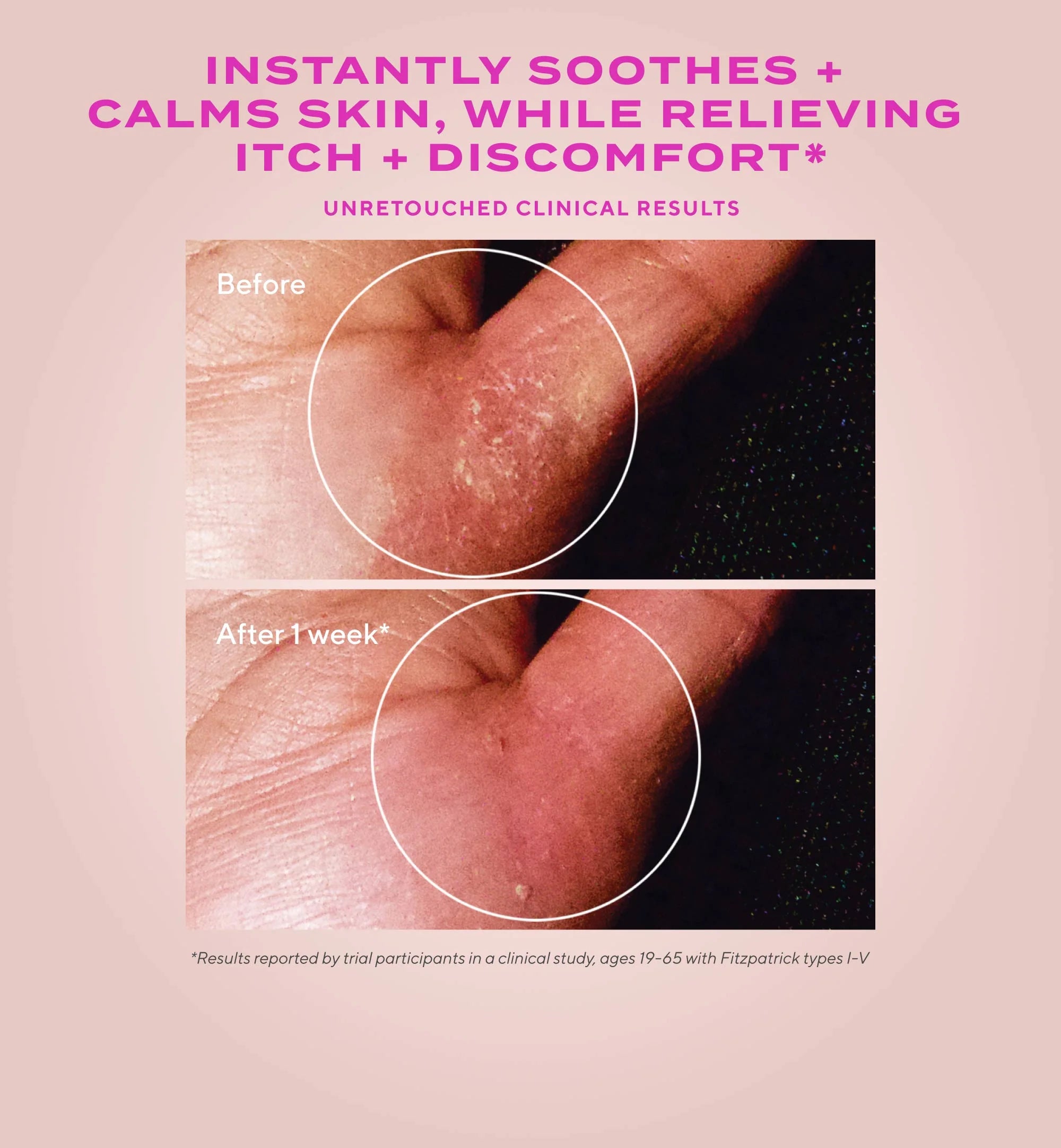 Quick Relief Colloidal Oatmeal Treatment