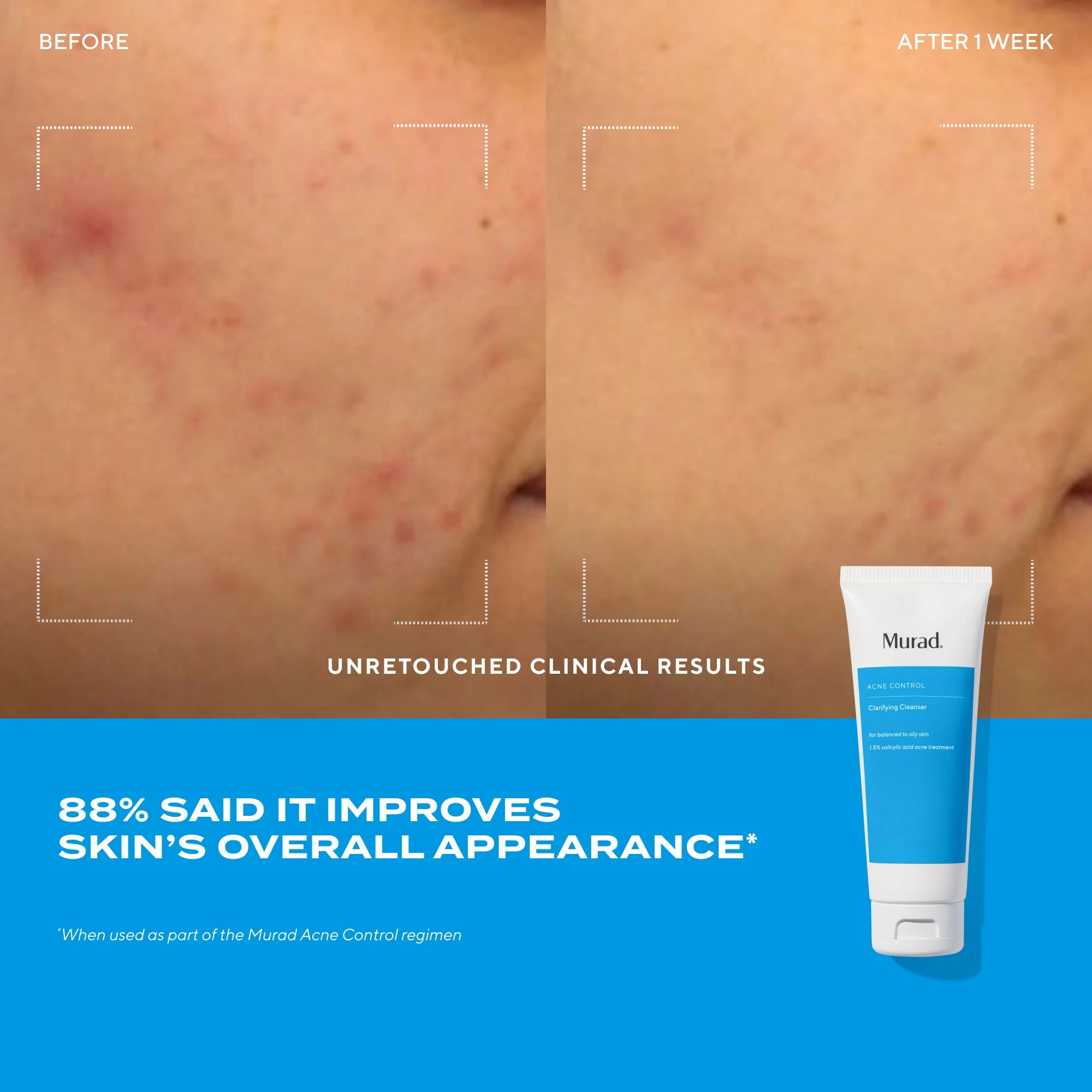 Clarifying Cleanser Travel Size