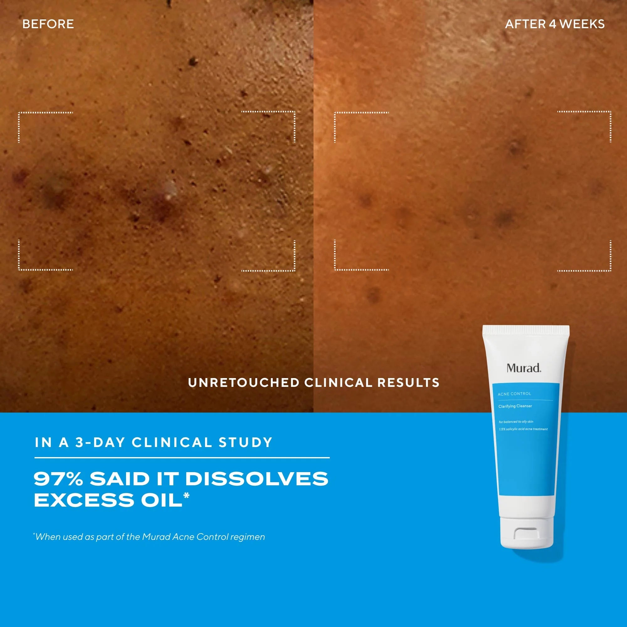 Clarifying Cleanser Travel Size