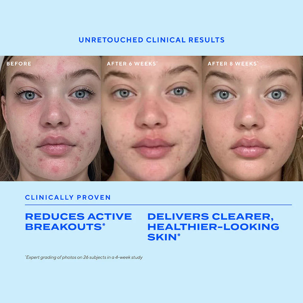 Biome-Balancing Clear & Prevent Blemish Treatment Serum