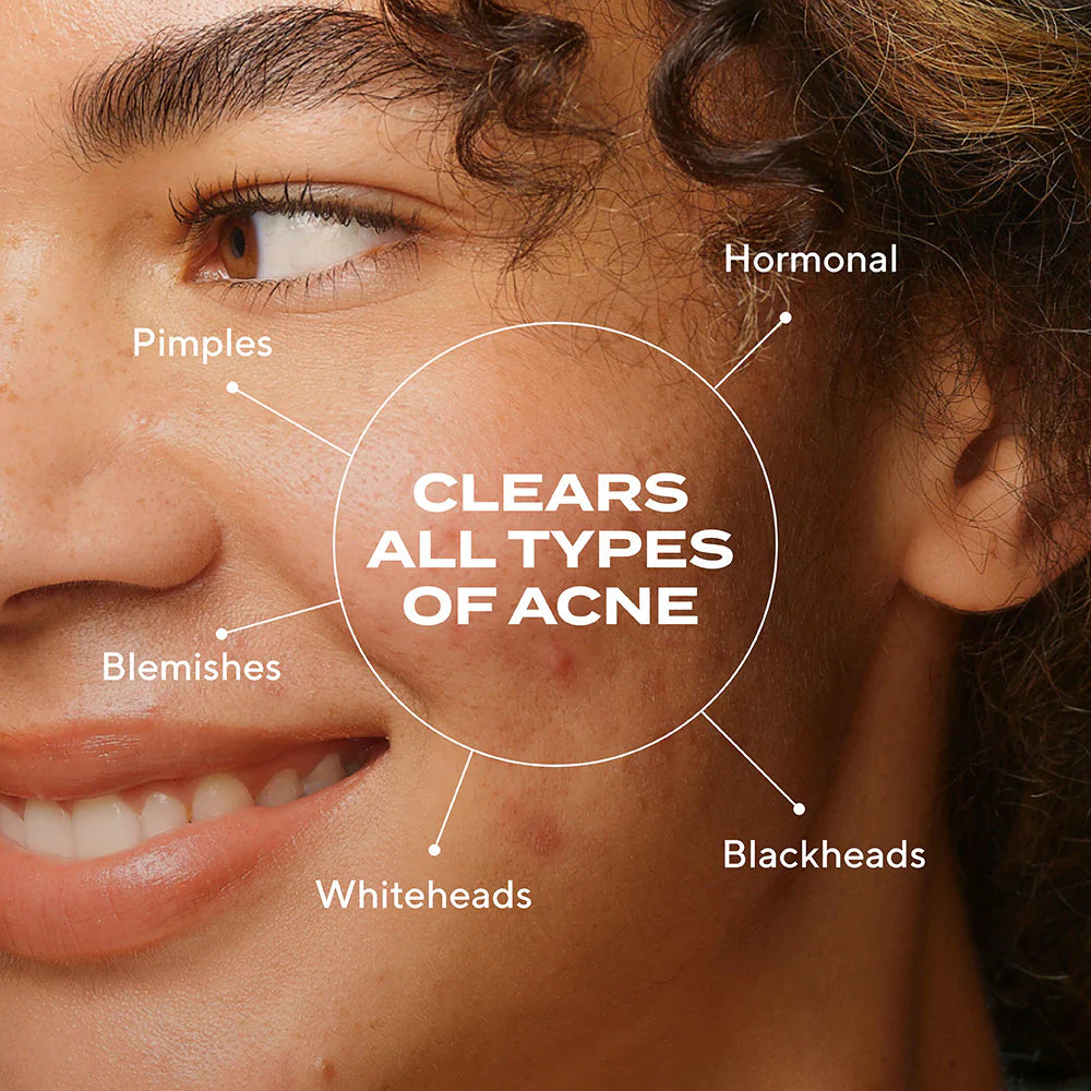 Biome-Balancing Clear & Prevent Blemish Treatment Serum