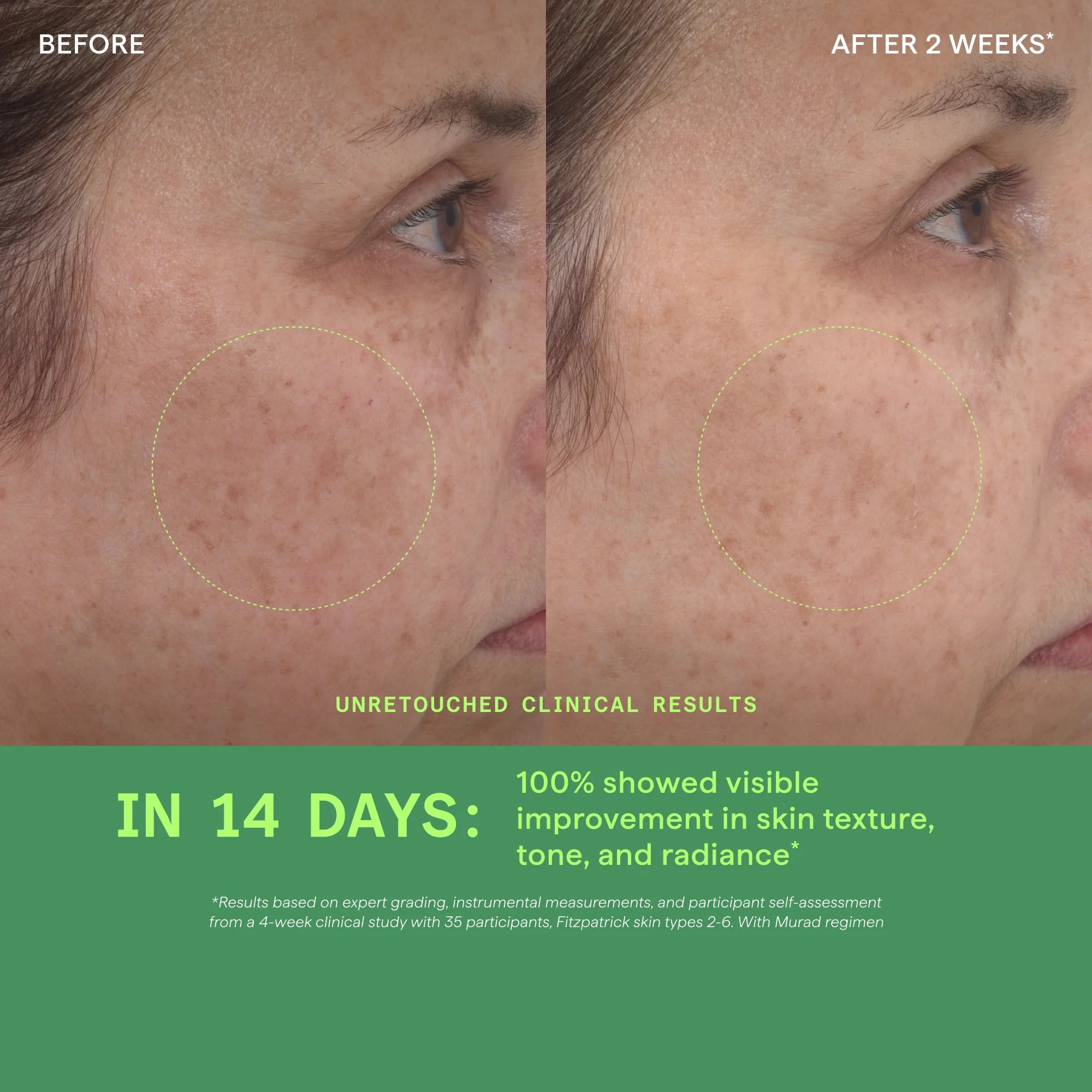Retinol Youth Renewal Serum Deluxe Travel