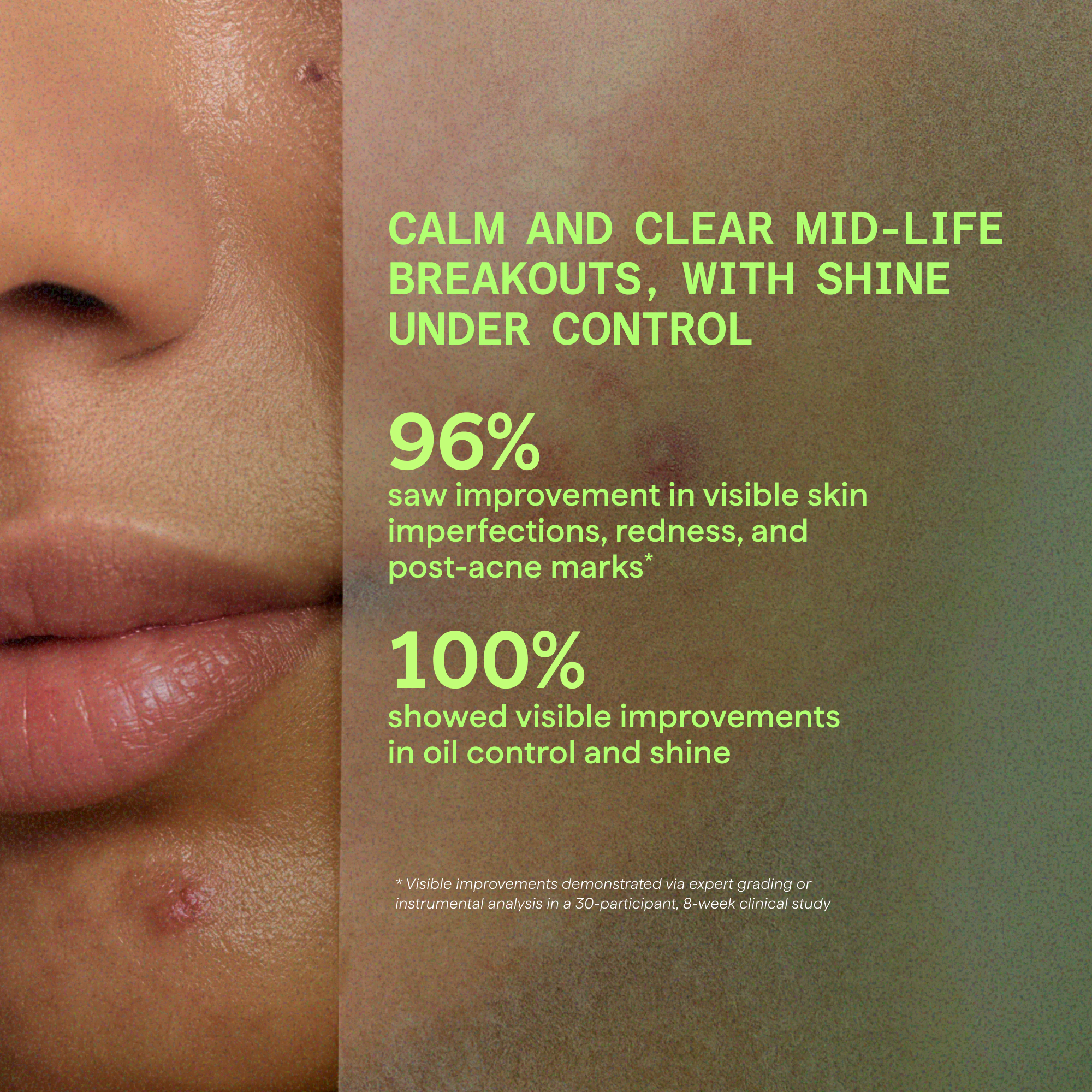 Biome-Balancing Calm + Recover Cream
